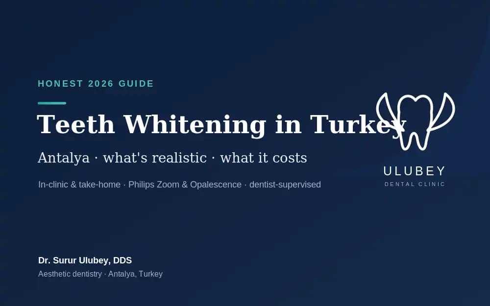 Teeth whitening in Turkey — honest cost and results guide, Ulubey Dental Clinic Antalya