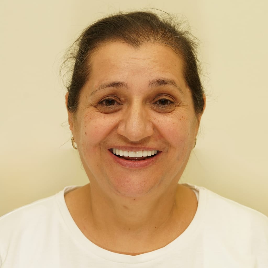 Patient testimonial: N.Ş., dental treatment at Ulubey Dental Clinic