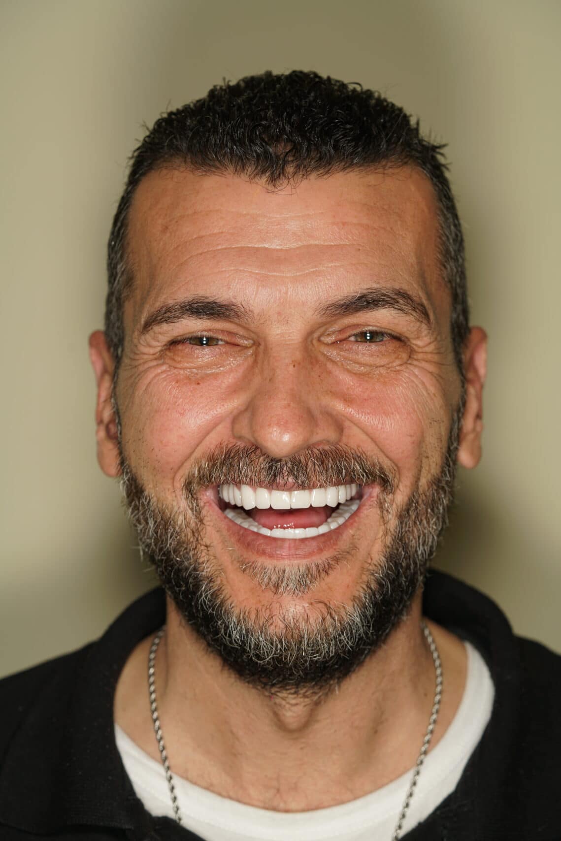 Portrait of a smiling patient after dental treatment at Ulubey Dental Clinic Antalya
