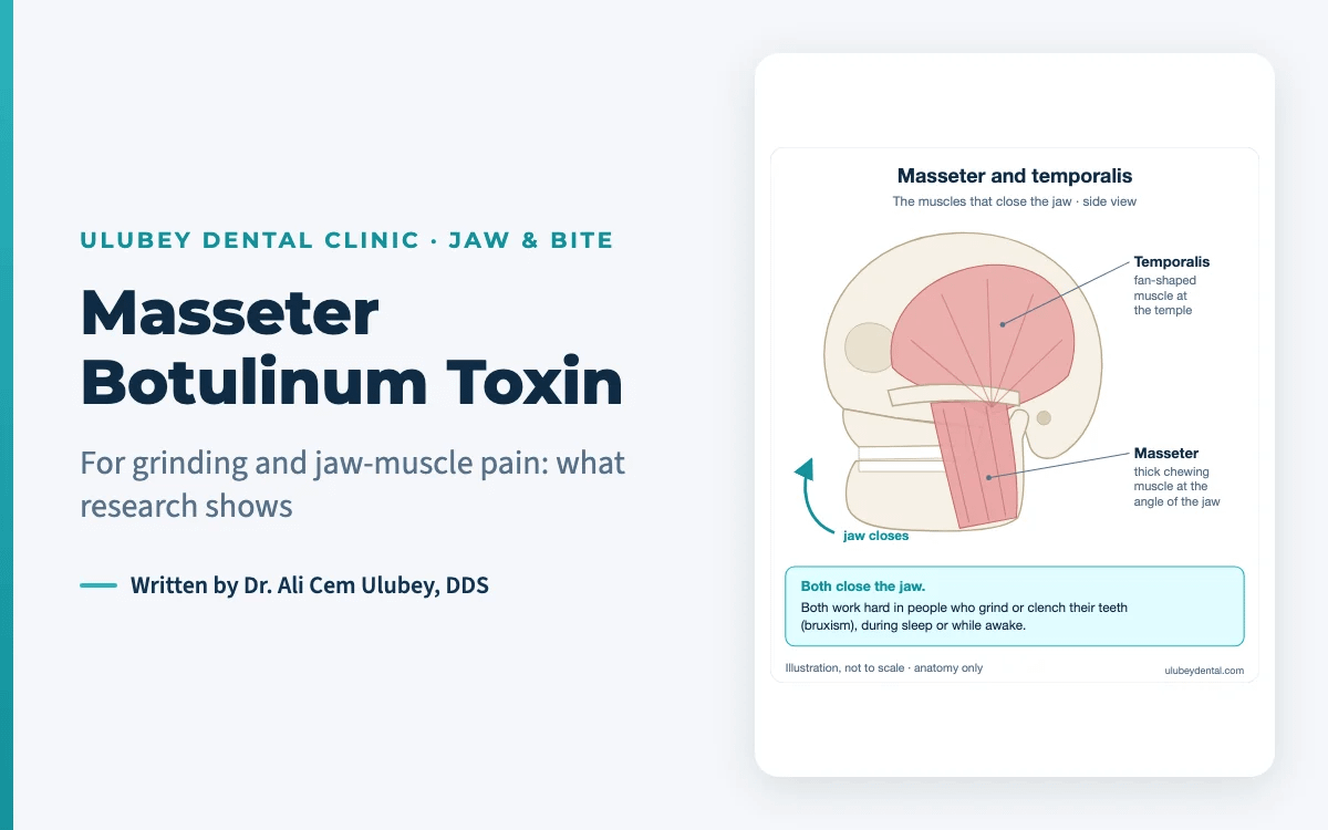 Featured image: masseter botulinum toxin for bruxism, with the jaw-closing muscles