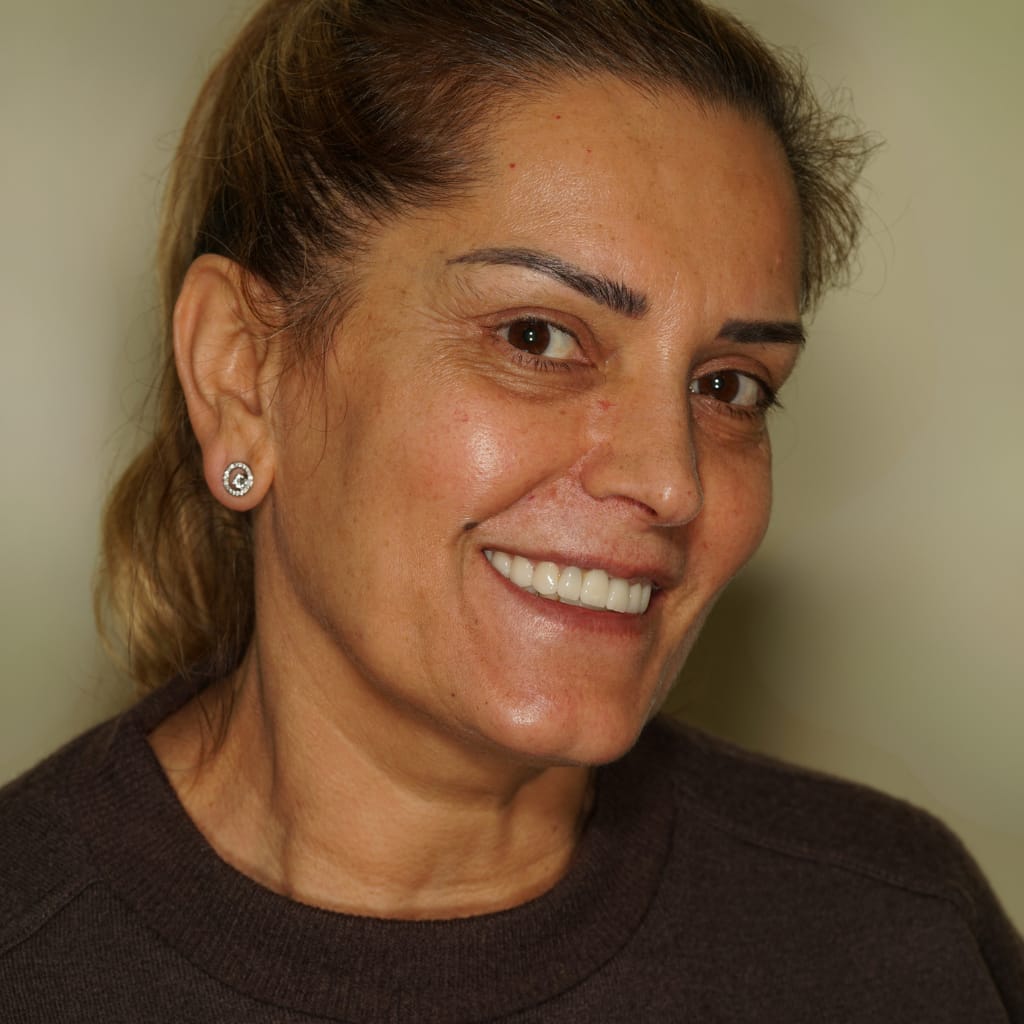 Patient testimonial — Zeynep Tosun E.max veneer treatment at Ulubey Dental Clinic