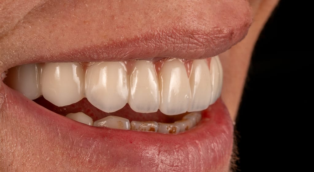 Ulubey Dental Clinic — smile desing treatment photo