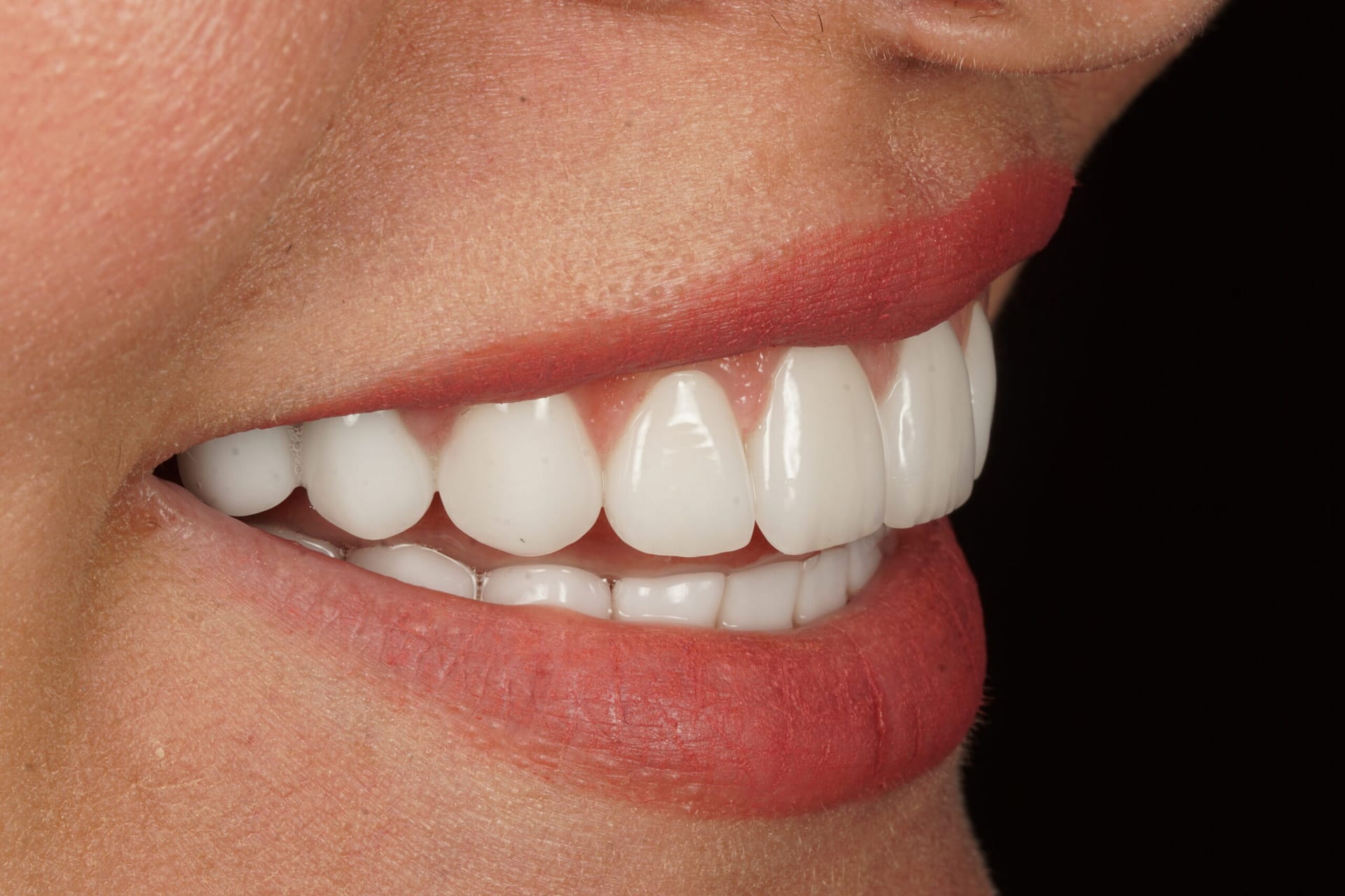 Smile design consultation in progress at Ulubey Dental Clinic Antalya